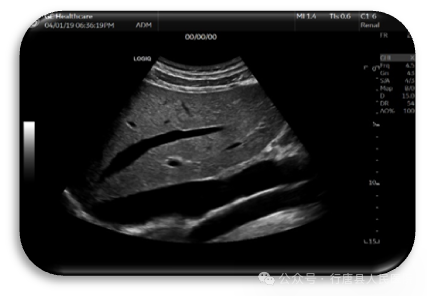 logiq e怎么读【高端设备】从多个维度观察血管、组织的血流灌注、像素合成在瞬间完成——美国GE超声高端旗舰机LOGIQ™ E11_https://www.jmylbn.com_新闻资讯_第8张