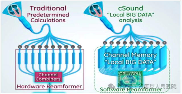 logiq e怎么读【高端设备】从多个维度观察血管、组织的血流灌注、像素合成在瞬间完成——美国GE超声高端旗舰机LOGIQ™ E11_https://www.jmylbn.com_新闻资讯_第4张