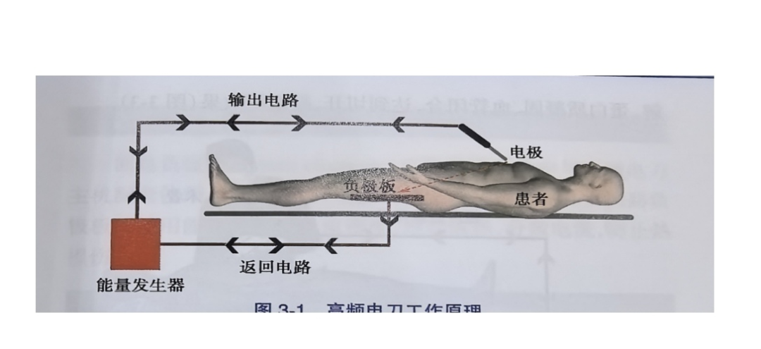 为什么手术用电刀熙暖手护｜‌手术室护理实践指南之手术室的电外科设备_https://www.jmylbn.com_新闻资讯_第3张