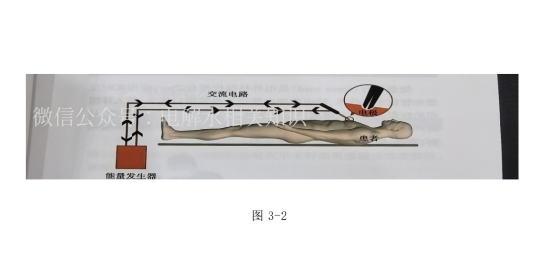 为什么手术用电刀熙暖手护｜‌手术室护理实践指南之手术室的电外科设备_https://www.jmylbn.com_新闻资讯_第4张