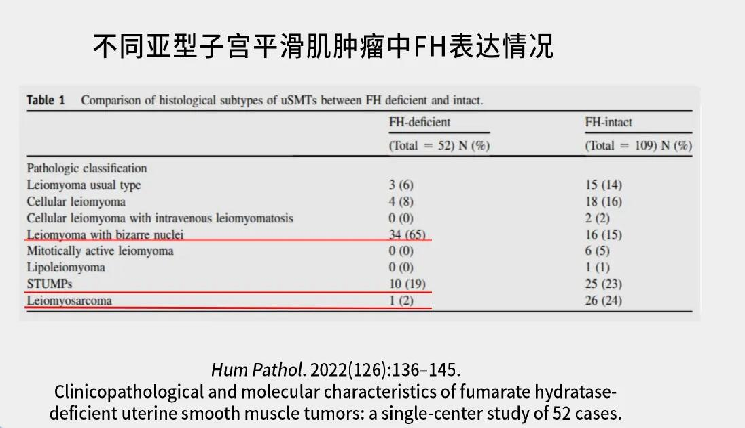 fh染色是什么意思讲座｜ FH缺失型子宫平滑肌瘤_https://www.jmylbn.com_新闻资讯_第31张