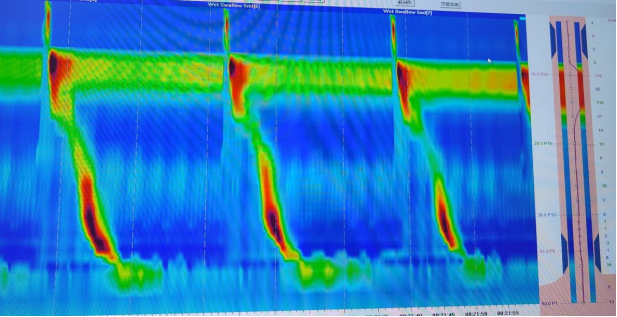 消化道动力检测怎么做【曲中科普】总是胃胀反酸却查不出问题？消化道动力检测来帮您！_https://www.jmylbn.com_新闻资讯_第2张