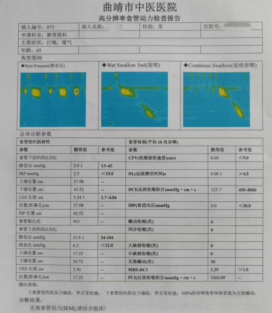 消化道动力检测怎么做【曲中科普】总是胃胀反酸却查不出问题？消化道动力检测来帮您！_https://www.jmylbn.com_新闻资讯_第4张
