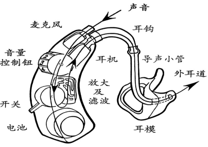 听筒结构图片