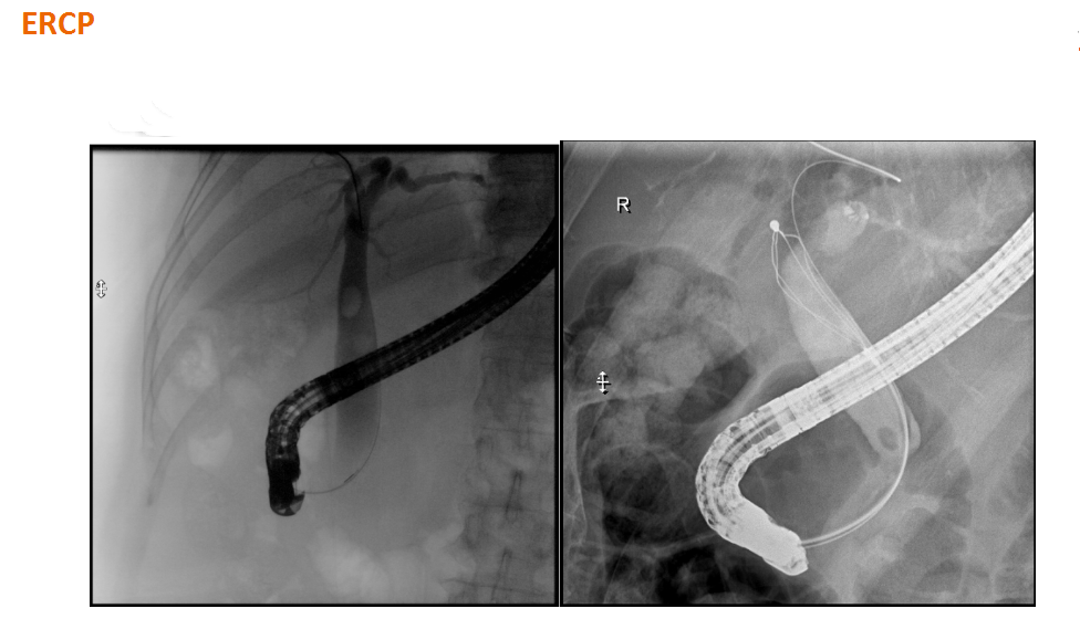 数字胃肠透视怎么做【先进设备】放射检查的“高清透视镜”：西门子Luminos dRF Max超高端数字胃肠机开启运行_https://www.jmylbn.com_新闻资讯_第11张