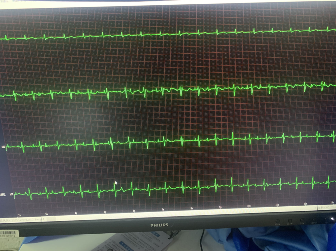 胎儿心电图是什么意思【科普】胎儿也可以做心电图了！您知道吗？_https://www.jmylbn.com_新闻资讯_第9张