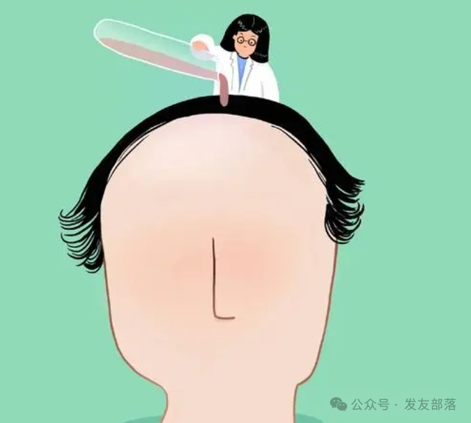 雄秃与脂溢性脱发：区分要点及治疗对策_雄秃、脂溢性脱发症状