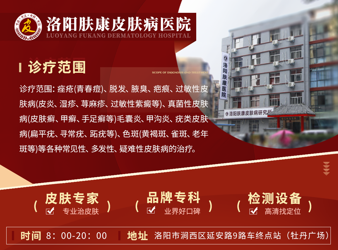 【洛阳肤康皮肤科医院】脂溢性皮炎引起的脱发怎么办？看完这篇文章你就知道了！