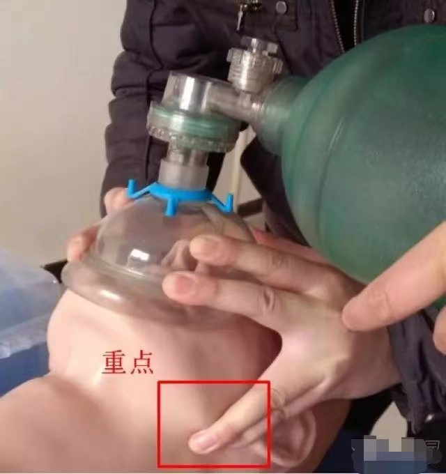 呼吸面罩怎么带麻醉科专业技术：面罩通气操作攻略_https://www.jmylbn.com_新闻资讯_第8张