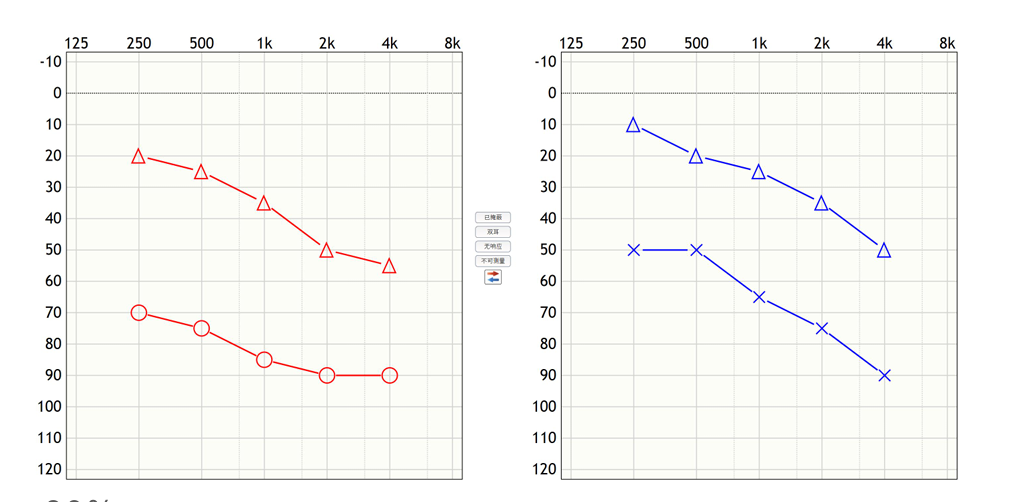 听力计怎么使用第十二期助听器验配师沙龙｜言语测听以及在助听器验配的应用_https://www.jmylbn.com_新闻资讯_第47张