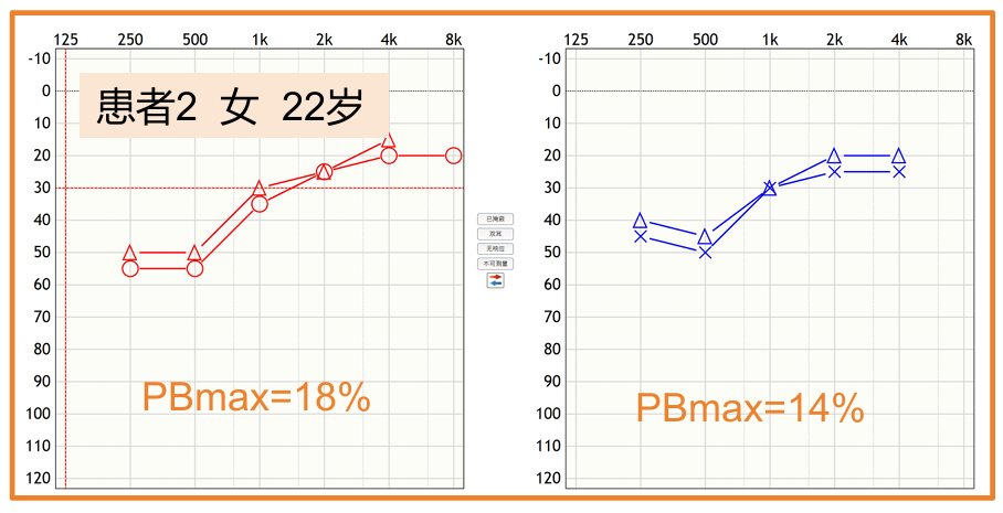 听力计怎么使用第十二期助听器验配师沙龙｜言语测听以及在助听器验配的应用_https://www.jmylbn.com_新闻资讯_第46张