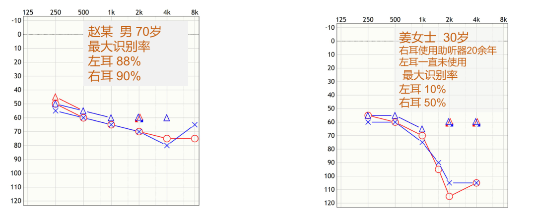 听力计怎么使用第十二期助听器验配师沙龙｜言语测听以及在助听器验配的应用_https://www.jmylbn.com_新闻资讯_第39张