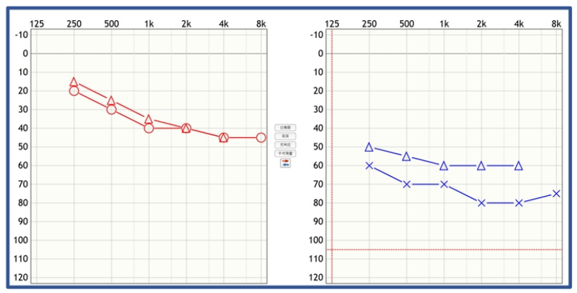 听力计怎么使用第十二期助听器验配师沙龙｜言语测听以及在助听器验配的应用_https://www.jmylbn.com_新闻资讯_第34张