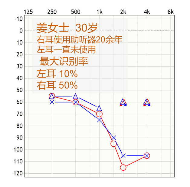 听力计怎么使用第十二期助听器验配师沙龙｜言语测听以及在助听器验配的应用_https://www.jmylbn.com_新闻资讯_第48张