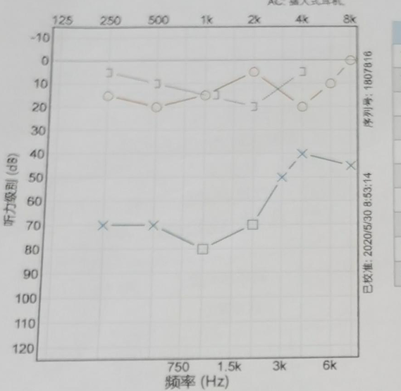 听力计怎么使用第十二期助听器验配师沙龙｜言语测听以及在助听器验配的应用_https://www.jmylbn.com_新闻资讯_第50张