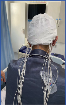 动态脑电图怎么看【特色技术】上新！24小时动态脑电图正式上线啦！_https://www.jmylbn.com_新闻资讯_第7张