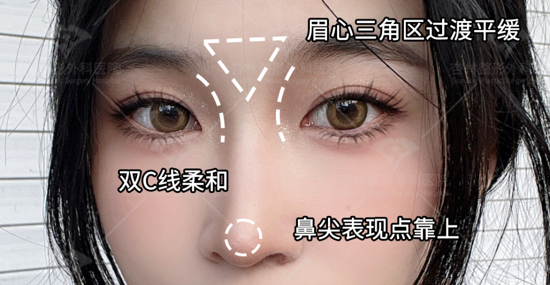 再凹的側臉也能變神顏——杏林改臉型