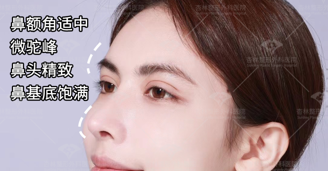 再凹的側臉也能變神顏——杏林改臉型