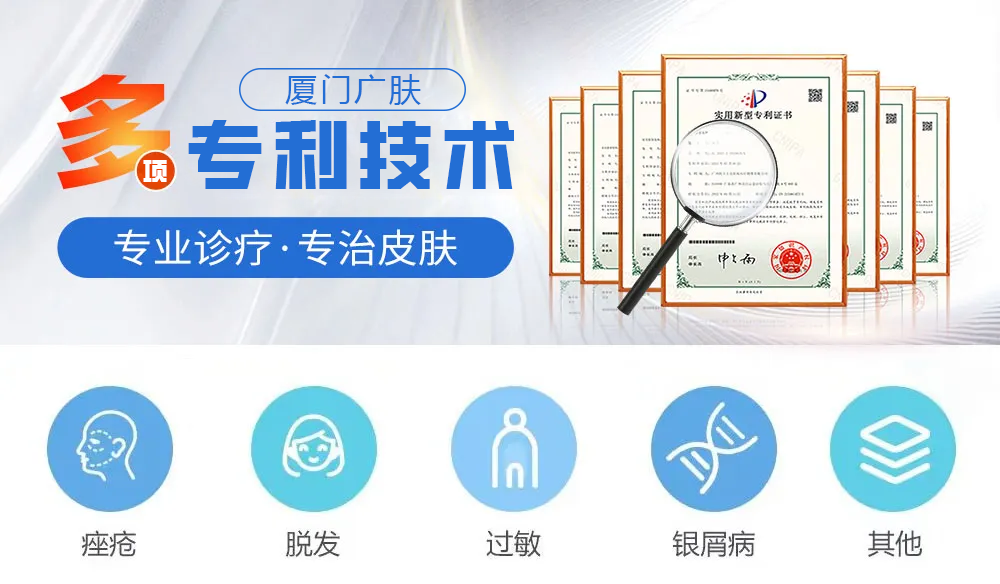 皮肤科普真菌感染会引起的皮肤病有哪些？