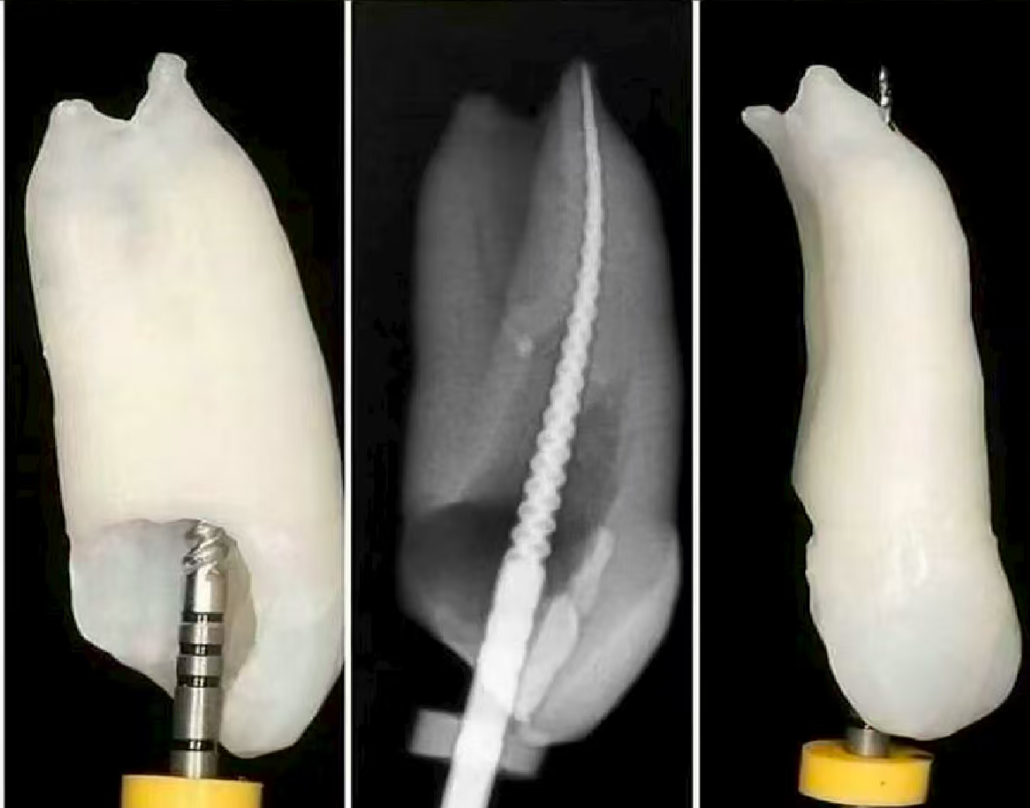根测仪测完后，为什么要退0.5-1mm，图片解析很清楚