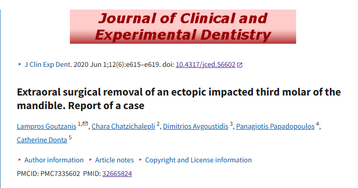 阻生智齿！从下颌缘入路进行拔除！值得一看