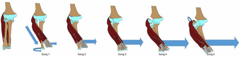 儿童肱骨外髁骨折的诊疗，本文全面总结！