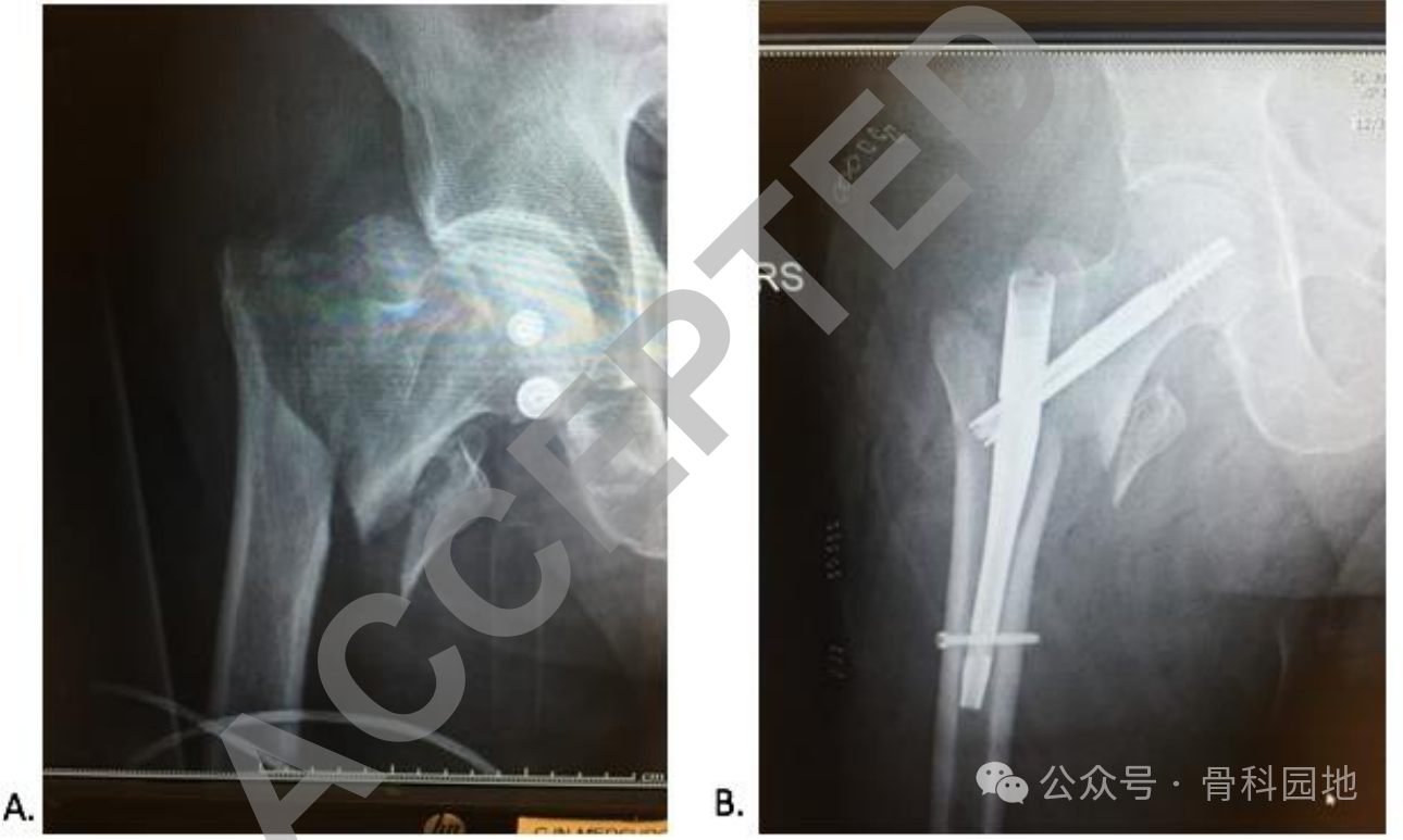【实用手术技巧