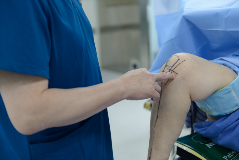 【滑动垫片单髁置换技术精讲系列】第一讲：麻醉、体位