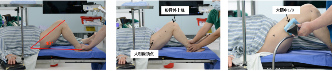 【滑动垫片单髁置换技术精讲系列】第一讲：麻醉、体位