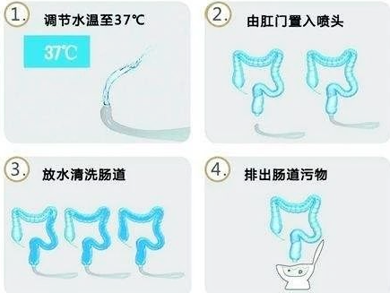 结肠水疗仪怎么用肠道也能做“SPA”？水疗助您“肠”通无阻！_https://www.jmylbn.com_新闻资讯_第7张