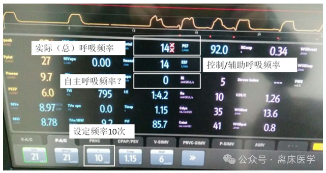 吸呼比怎么调机械通气小王子：呼吸频率、吸呼比_https://www.jmylbn.com_新闻资讯_第8张