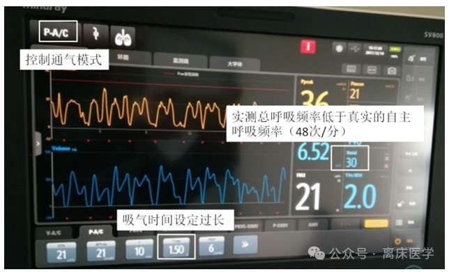 吸呼比怎么调机械通气小王子：呼吸频率、吸呼比_https://www.jmylbn.com_新闻资讯_第11张
