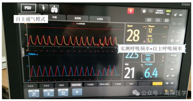 吸呼比怎么调机械通气小王子：呼吸频率、吸呼比_https://www.jmylbn.com_新闻资讯_第10张