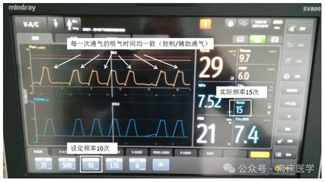 吸呼比怎么调机械通气小王子：呼吸频率、吸呼比_https://www.jmylbn.com_新闻资讯_第4张