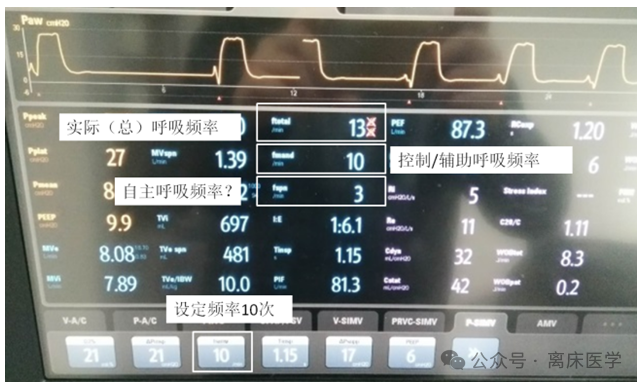 吸呼比怎么调机械通气小王子：呼吸频率、吸呼比_https://www.jmylbn.com_新闻资讯_第7张