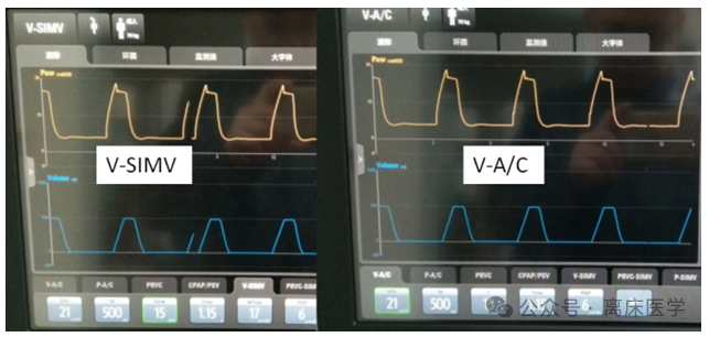吸呼比怎么调机械通气小王子：呼吸频率、吸呼比_https://www.jmylbn.com_新闻资讯_第3张
