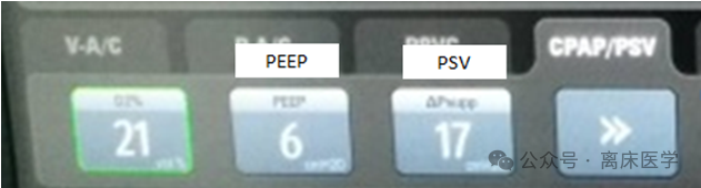 呼吸机f什么意思机械通气小王子：常用无创呼吸机通气模式介绍_https://www.jmylbn.com_新闻资讯_第2张
