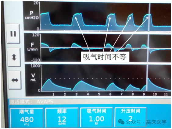avaps模式是什么机械通气小王子：智能无创通气模式—AVAPS_https://www.jmylbn.com_新闻资讯_第3张