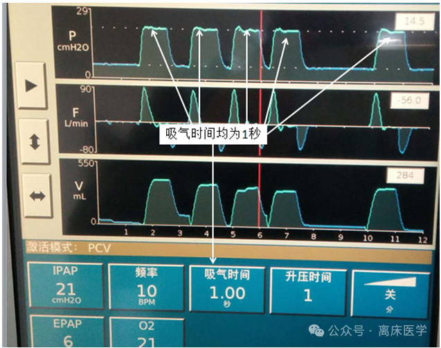 呼吸机f什么意思机械通气小王子：常用无创呼吸机通气模式介绍_https://www.jmylbn.com_新闻资讯_第12张