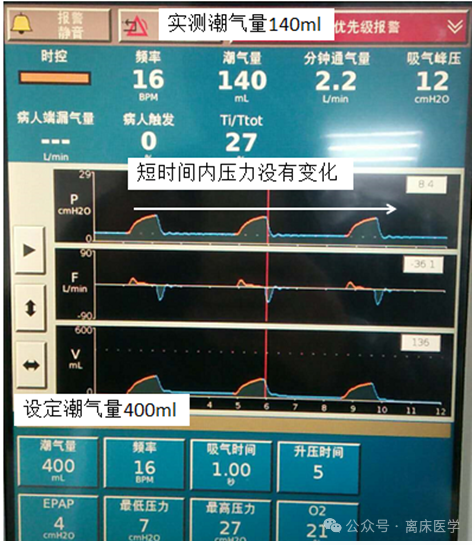avaps模式是什么机械通气小王子：智能无创通气模式—AVAPS_https://www.jmylbn.com_新闻资讯_第4张