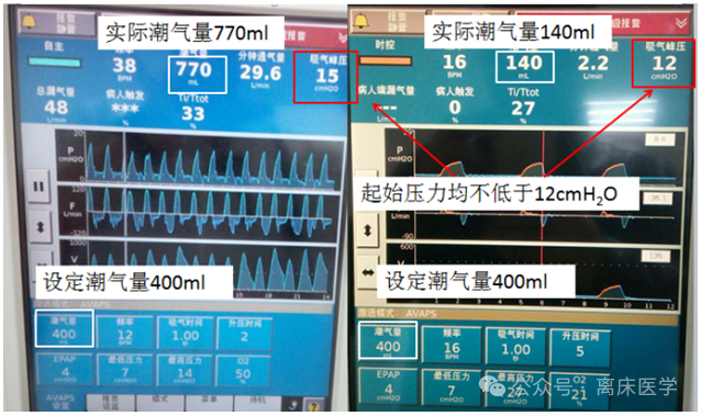 avaps模式是什么机械通气小王子：智能无创通气模式—AVAPS_https://www.jmylbn.com_新闻资讯_第5张