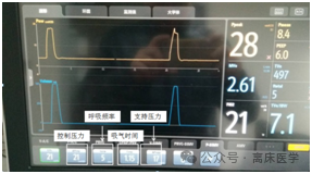 呼吸机怎么看自主呼吸机械通气小白：五种基本机械通气模式_https://www.jmylbn.com_新闻资讯_第10张