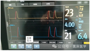 呼吸机怎么看自主呼吸机械通气小白：五种基本机械通气模式_https://www.jmylbn.com_新闻资讯_第7张