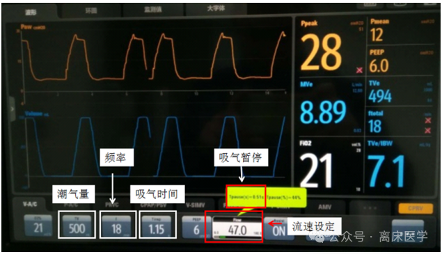 呼吸机怎么看自主呼吸机械通气小白：五种基本机械通气模式_https://www.jmylbn.com_新闻资讯_第3张