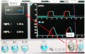 呼吸机怎么看自主呼吸机械通气小白：五种基本机械通气模式_https://www.jmylbn.com_新闻资讯_第4张