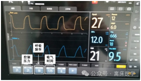 呼吸机怎么看自主呼吸机械通气小白：五种基本机械通气模式_https://www.jmylbn.com_新闻资讯_第6张