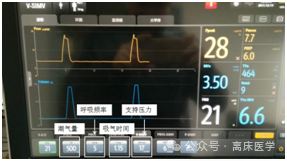 呼吸机怎么看自主呼吸机械通气小白：五种基本机械通气模式_https://www.jmylbn.com_新闻资讯_第9张