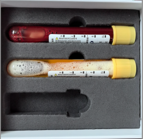 病理切片快递怎么包装蜡块、白片、胶片，血液、胸腹水、脑脊液，这么多标本，凌乱了吗？【附标本获取、邮寄包装注意事项】_https://www.jmylbn.com_新闻资讯_第9张