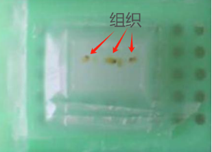 病理切片快递怎么包装蜡块、白片、胶片，血液、胸腹水、脑脊液，这么多标本，凌乱了吗？【附标本获取、邮寄包装注意事项】_https://www.jmylbn.com_新闻资讯_第3张