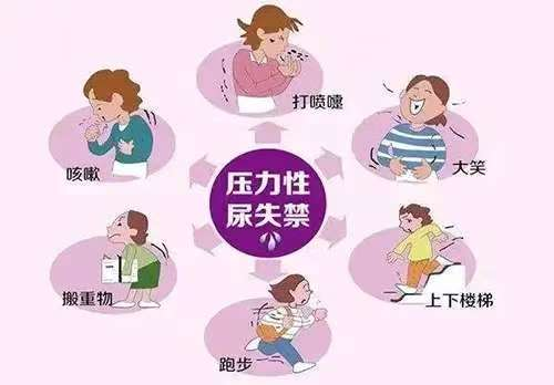 尿道张力过强怎么办女性福音！阴道闭孔无张力尿道中段悬吊术（TVT-O）解决漏尿尴尬_https://www.jmylbn.com_新闻资讯_第3张